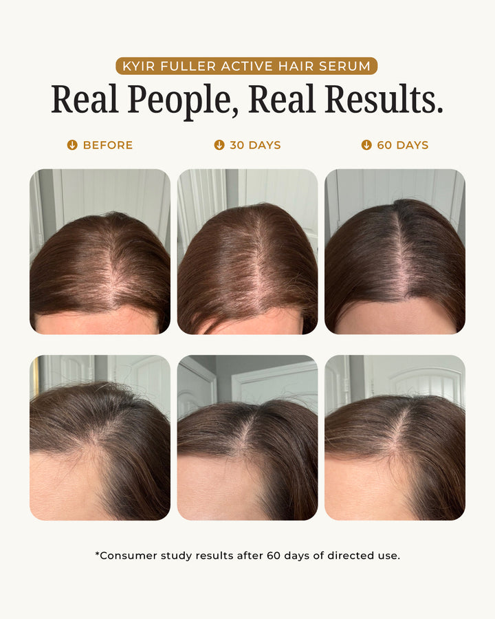 Zovost Hair Growth Serum