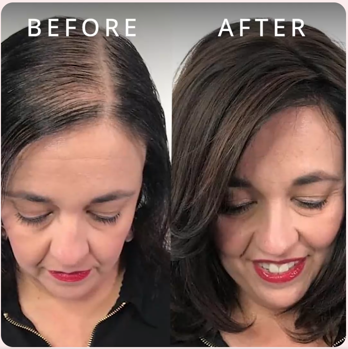 RoburstAge Hair Growth Serum