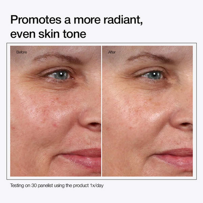 Zovost Glycolic Acid 7% Toning Solution