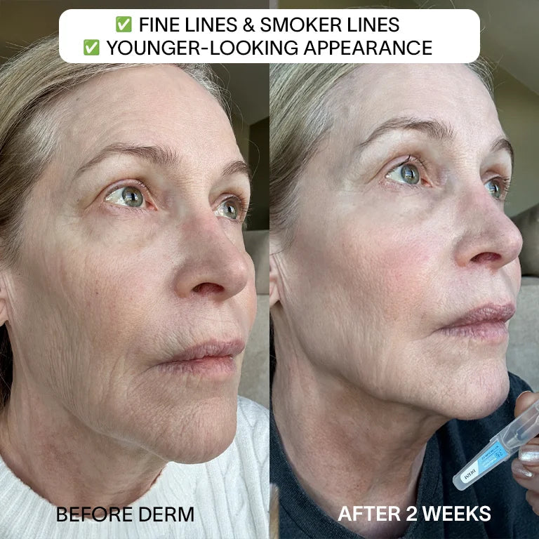 Zovost 3% Hyaluronic Acid Serum