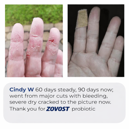Zovost Skin Probiotic
