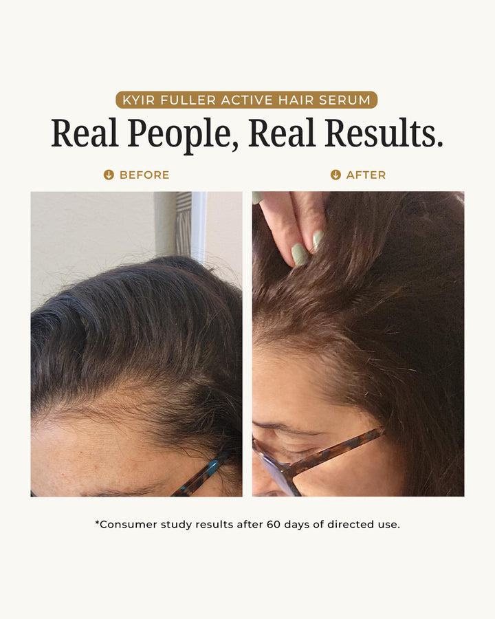 Zovost Hair Growth Serum