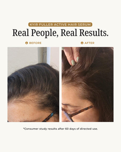 Zovost Hair Growth Serum