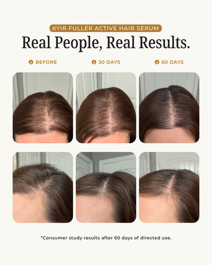 Zovost Hair Growth Serum