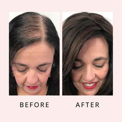 Zovost Hair Growth Serum