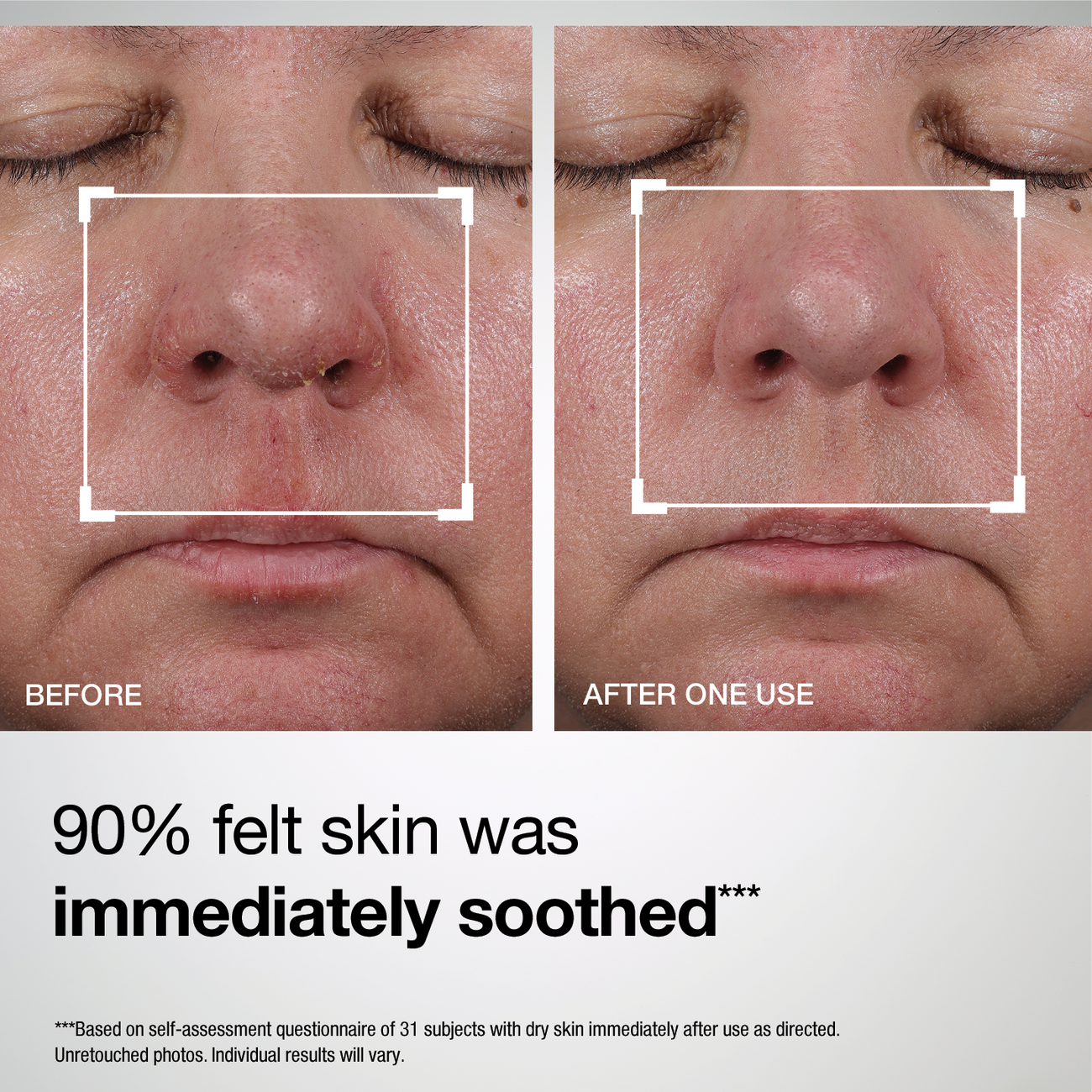 Skin Barrier Repair Ceramide Cream