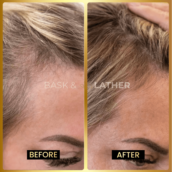 Zovost Growth & Length Retention Bundle