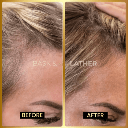 Zovost Growth & Length Retention Bundle