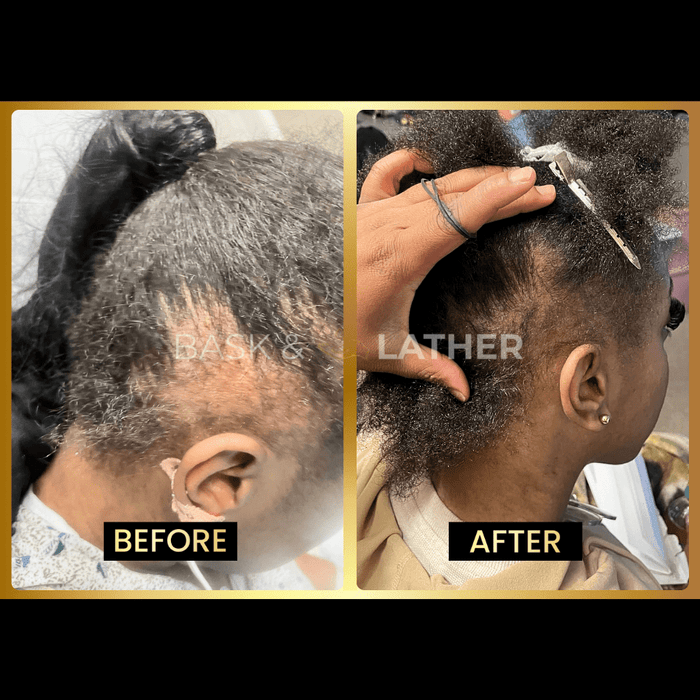 Zovost Growth & Length Retention Bundle