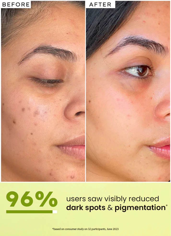 Zovost Brightening Serum