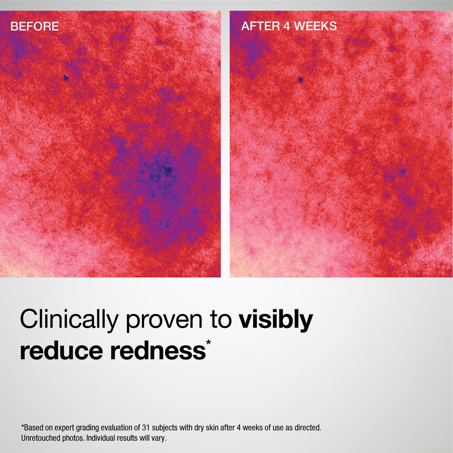 Skin Barrier Repair Ceramide Cream