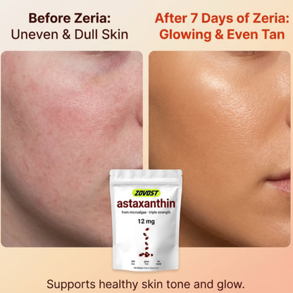 Zovost Astaxanthin