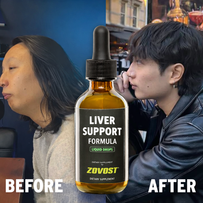 Zovost Liver Support Formula